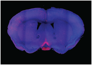 A coronal view of a mouse brain showing the location of light-sensing cells relative to the rest of the brain.